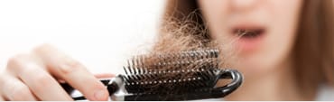 Hair Loss