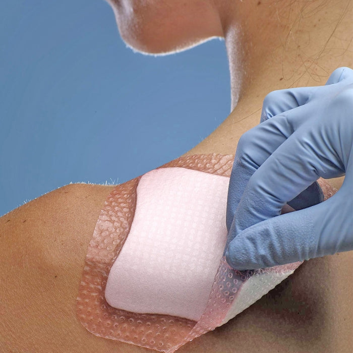 Allevyn Gentle Border 7.5 × 7.5 cm – 10 Dressings (Sensitive Skin Foam Dressing)